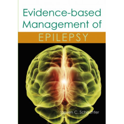Evidence-based Management of Epilepsy