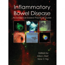 Inflammatory Bowel Disease: an Evidence-based Practical Guide