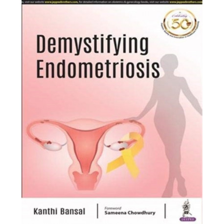 Demystifying Endometriosis