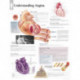 Understanding Angina Paper Poster