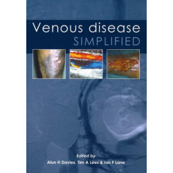 Venous Disease Simplified
