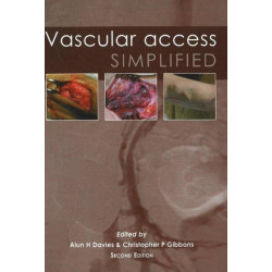 Vascular Access Simplified- second edition: 2nd Edition