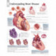 Understanding Heart Disease Laminated Poster