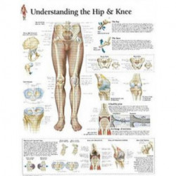 Understanding the Hip & Knee Laminated Poster