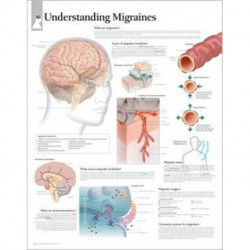 Understanding Migraines Laminated Poster