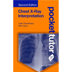 Pocket Tutor Chest X-Ray Interpretation: Second Edition