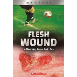 Flesh Wound: A Minor Injury Takes a Deadly Turn (XBooks): A Minor Injury Takes a Deadly Turn