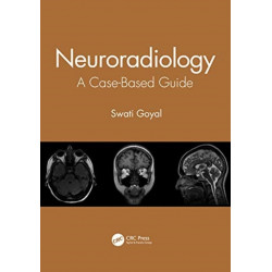 Neuroradiology: A Case-Based Guide