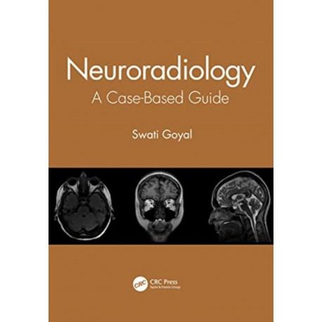 Neuroradiology: A Case-Based Guide