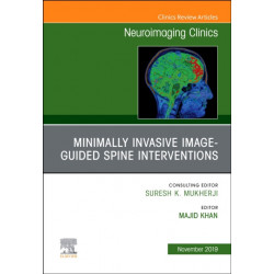Spine Intervention, An Issue of Neuroimaging Clinics of North America