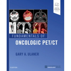 Fundamentals of Oncologic PET/CT