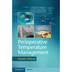 Perioperative Temperature Management