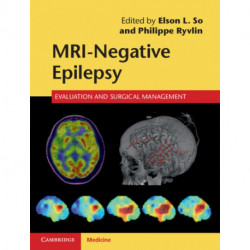 MRI-Negative Epilepsy: Evaluation and Surgical Management
