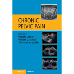 Chronic Pelvic Pain