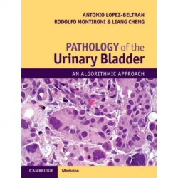 Pathology of the Urinary Bladder: An Algorithmic Approach