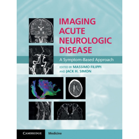 Imaging Acute Neurologic Disease: A Symptom-Based Approach
