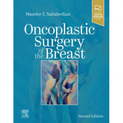 Oncoplastic Surgery of the Breast