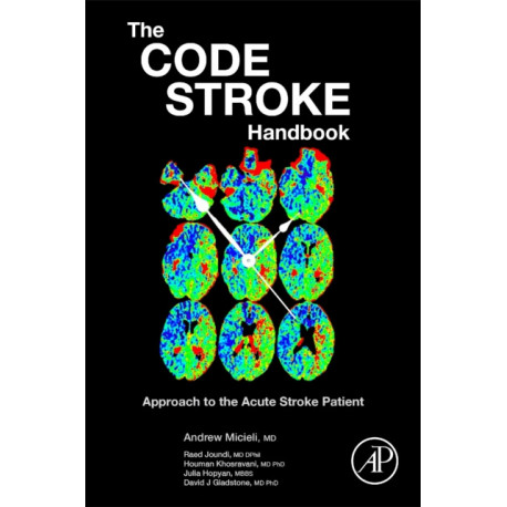 The Code Stroke Handbook: Approach to the Acute Stroke Patient