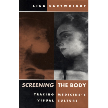 Screening the Body: Tracing Medicine's Visual Culture