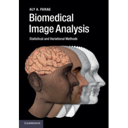 Biomedical Image Analysis: Statistical and Variational Methods
