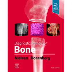 Diagnostic Pathology: Bone