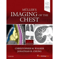 Muller's Imaging of the Chest: Expert Radiology Series
