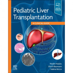 Pediatric Liver Transplantation: A Clinical Guide