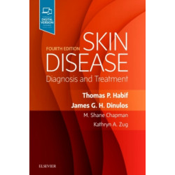 Skin Disease: Diagnosis and Treatment