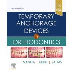 Temporary Anchorage Devices in Orthodontics