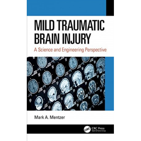 Mild Traumatic Brain Injury: A Science and Engineering Perspective