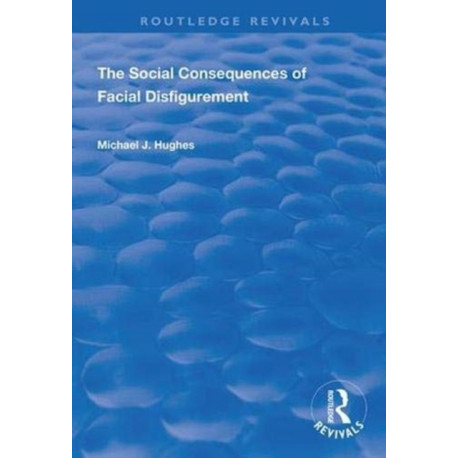 The Social Consequences of Facial Disfigurement