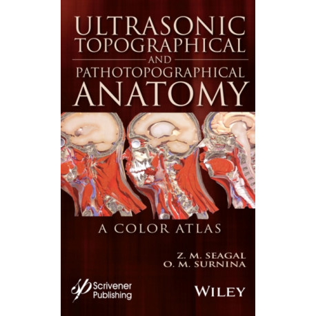 Ultrasonic Topographical and Pathotopographical Anatomy: A Color Atlas
