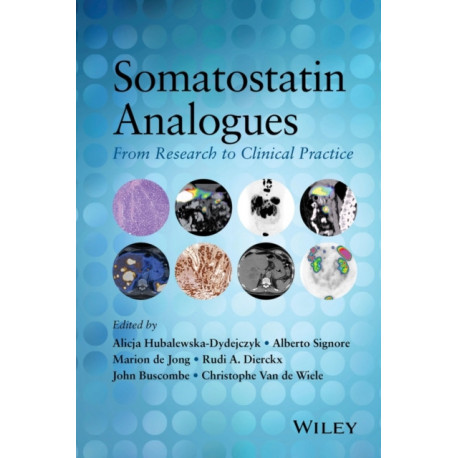 Somatostatin Analogues: From Research to Clinical Practice