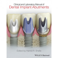 Clinical and Laboratory Manual of Dental Implant Abutments
