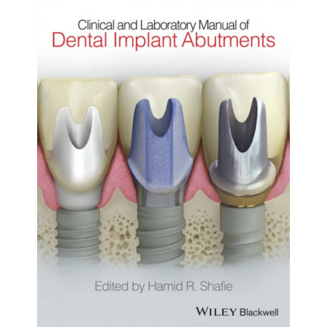 Clinical and Laboratory Manual of Dental Implant Abutments