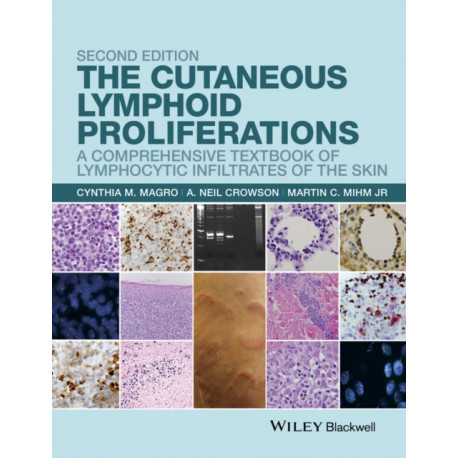The Cutaneous Lymphoid Proliferations: A Comprehensive Textbook of Lymphocytic Infiltrates of the Skin