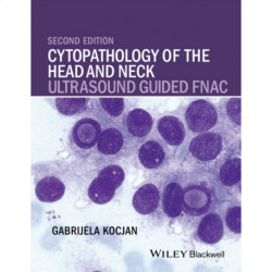 Cytopathology of the Head and Neck: Ultrasound Guided FNAC