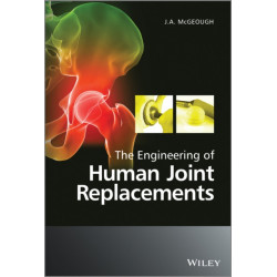 The Engineering of Human Joint Replacements