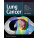 Lung Cancer