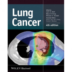 Lung Cancer