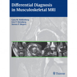 Differential Diagnosis in Musculoskeletal MR