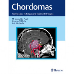 Chordomas: Technologies, Techniques, and Treatment Strategies