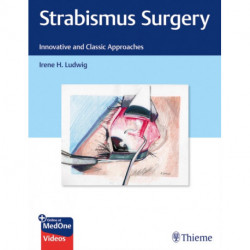 Strabismus Surgery: Innovative and Classic Approaches