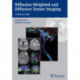 Diffusion Weighted and Diffusion Tensor Imaging: A Clinical Guide