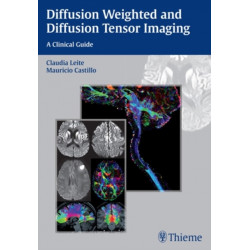 Diffusion Weighted and Diffusion Tensor Imaging: A Clinical Guide