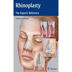 Rhinoplasty: The Experts' Reference