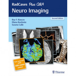 RadCases Plus Q&a Neuro Imaging