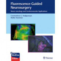 Fluorescence-Guided Neurosurgery: Neuro-oncology and Cerebrovascular Applications