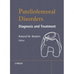 Patellofemoral Disorders: Diagnosis and Treatment