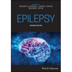Epilepsy